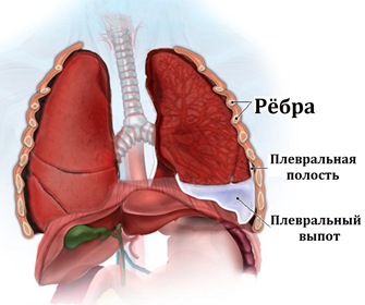 Кислородные концентраторы при плеврите