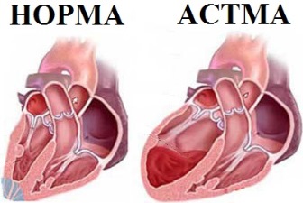 Кислородные концентраторы при сердечной астме