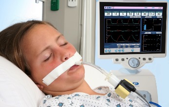 Концентраторы кислорода Event Medical