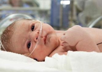 Неонатальные назальные кислородные канюли (для новорождённых малышей)